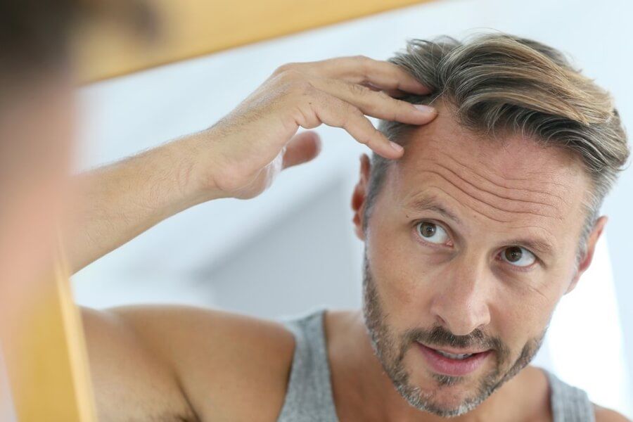 9 Things You Must Know Before Getting Hair Transplants
