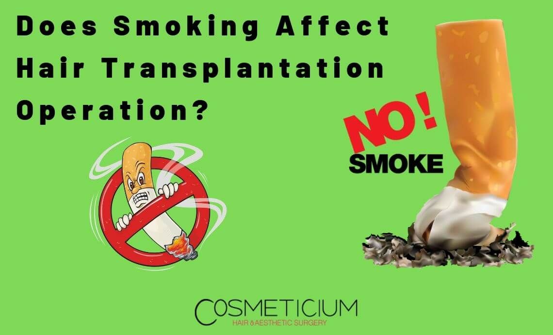 Does Smoking Affect Hair Transplantation Operation?