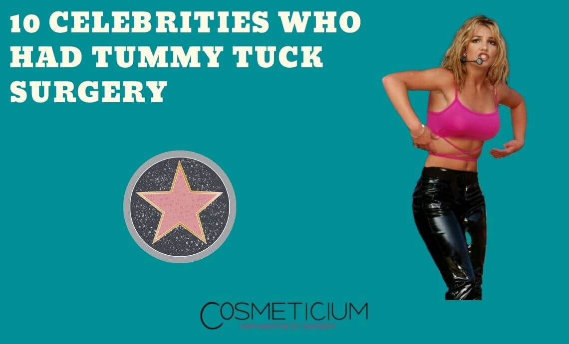 10 Celebrities Who Had Tummy Tuck Surgery