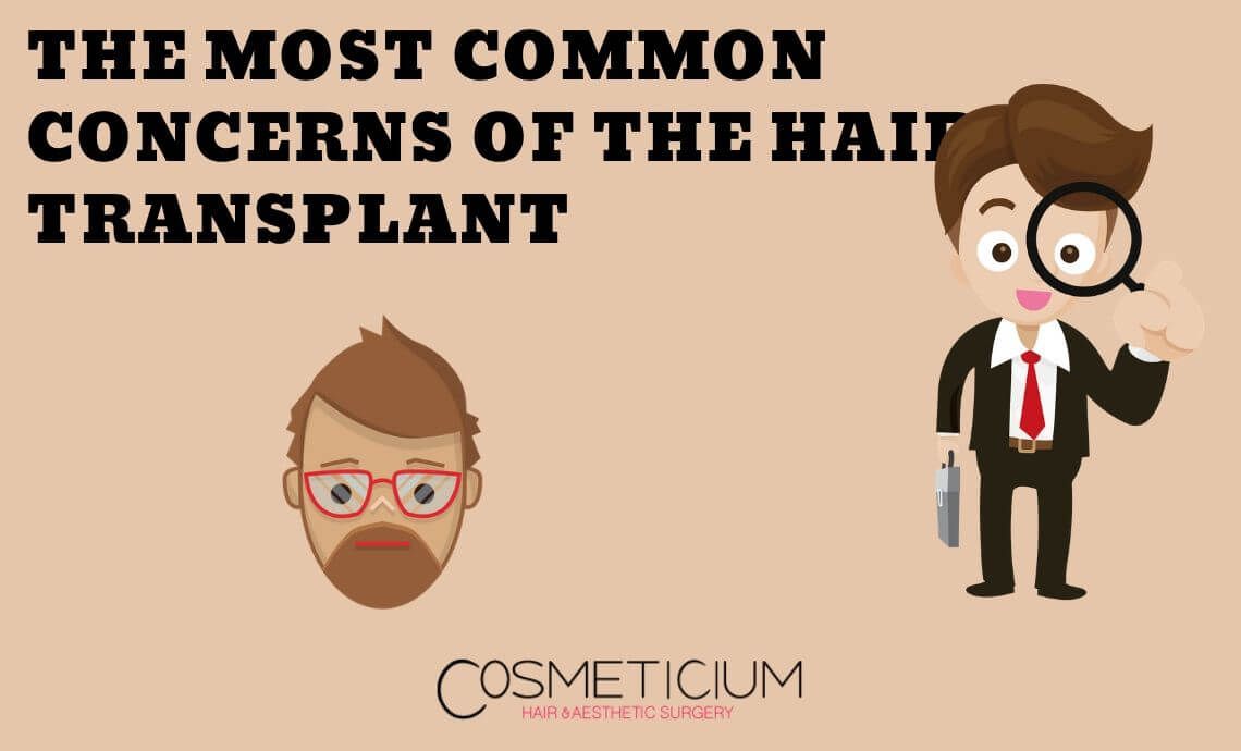 The Most Common Concerns of the Hair Transplantation