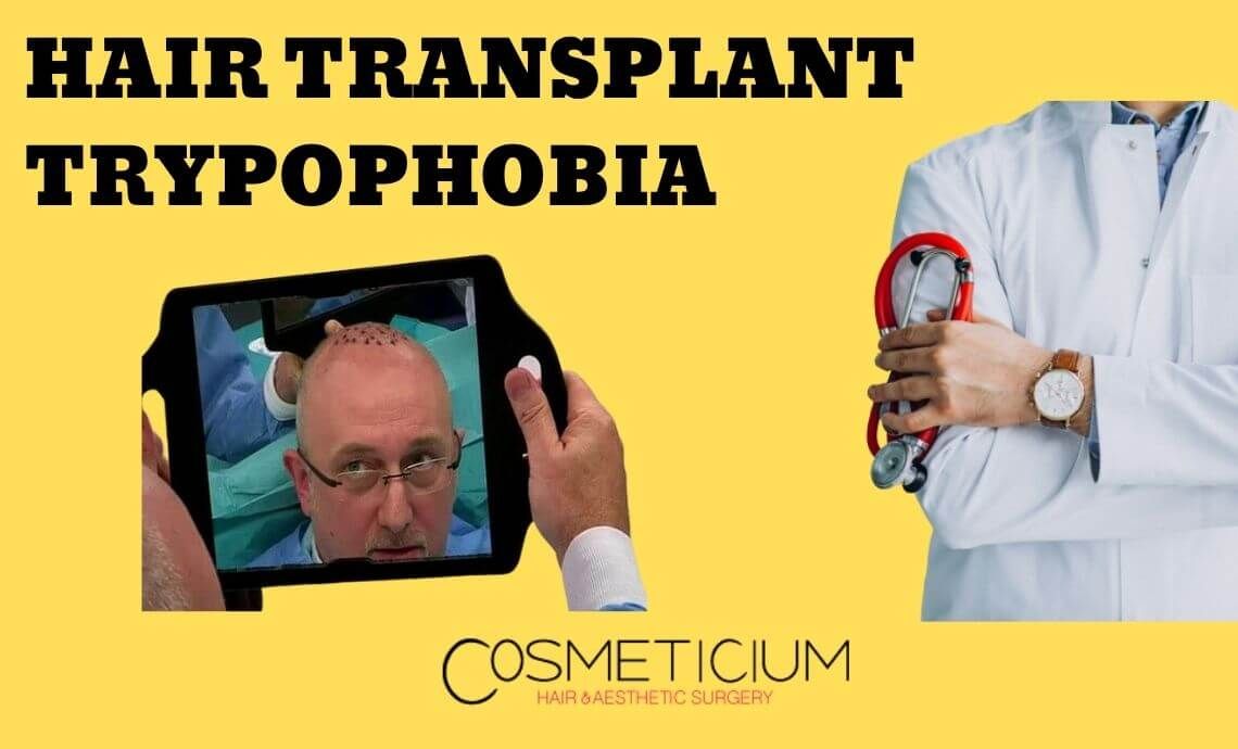 Hair Transplant Trypophobia: Conquer the Fear of Holes on the Scalp
