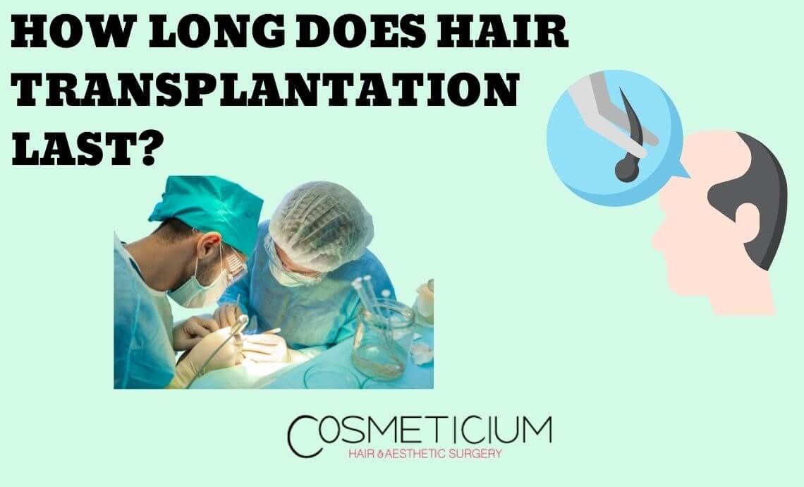 How Long Does Hair Transplantation Last? Expectations & Realities