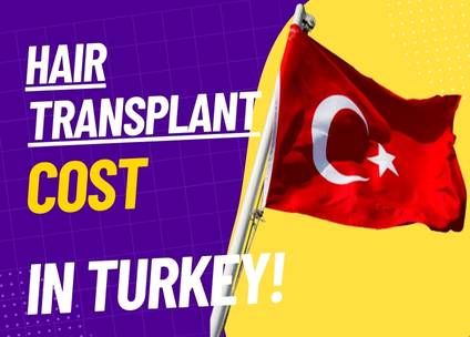 Hair Transplant Turkey Cost: An In-depth Look at Prices and Benefits