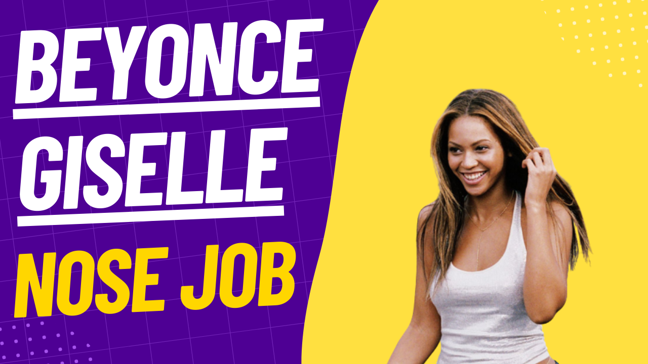 The Buzz about Beyoncé’s Nose Job